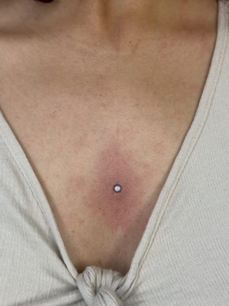 Microdermal piercing Camilo Barreto