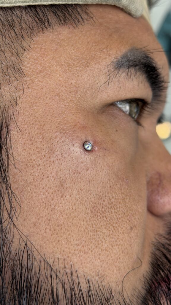 Microdermal piercing Camilo Barreto