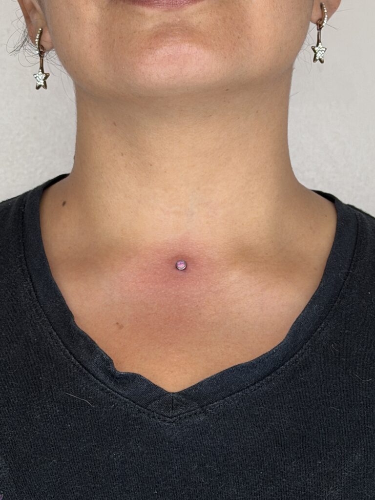 Microdermal piercing Camilo Barreto