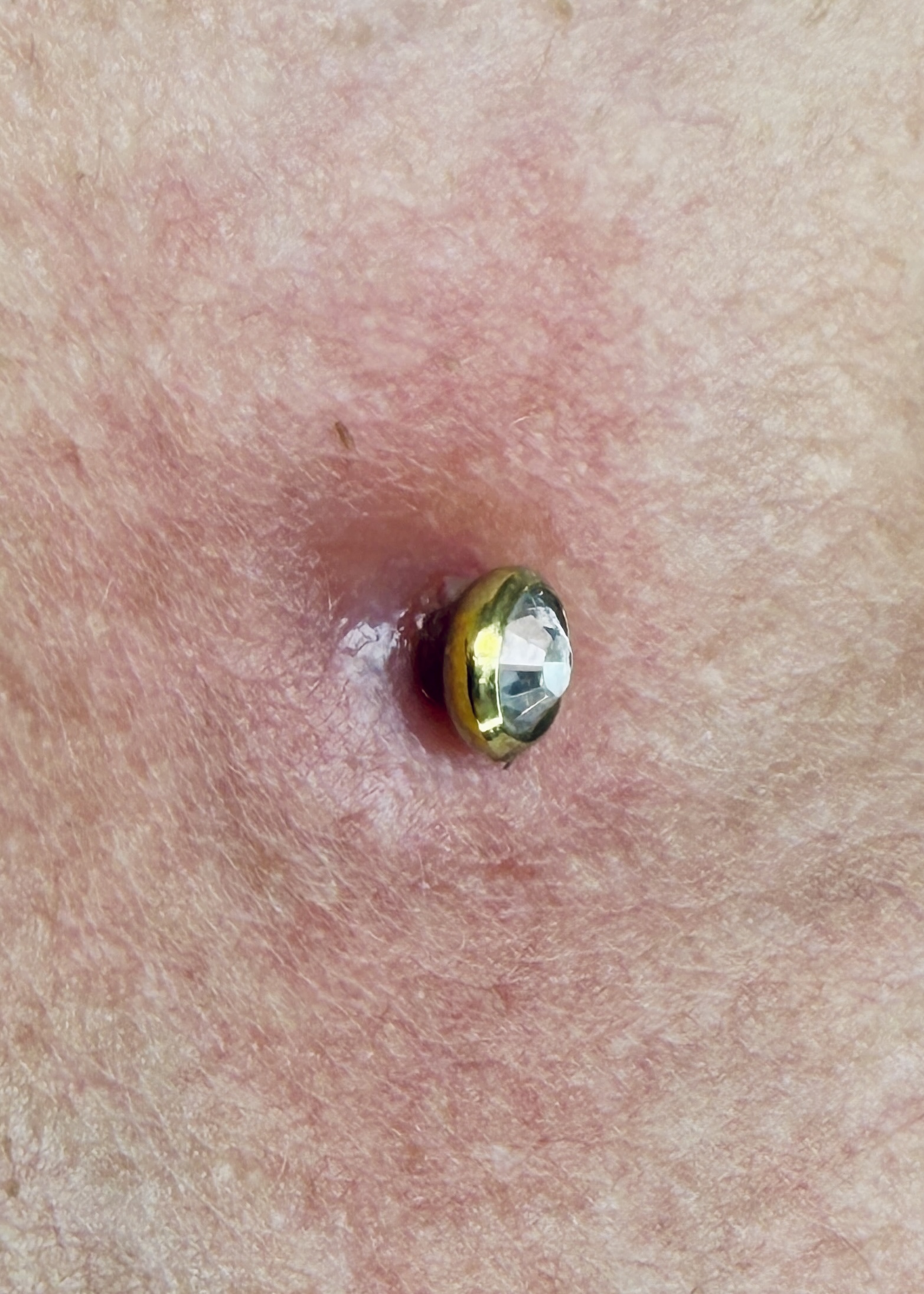 Complicación microdermal