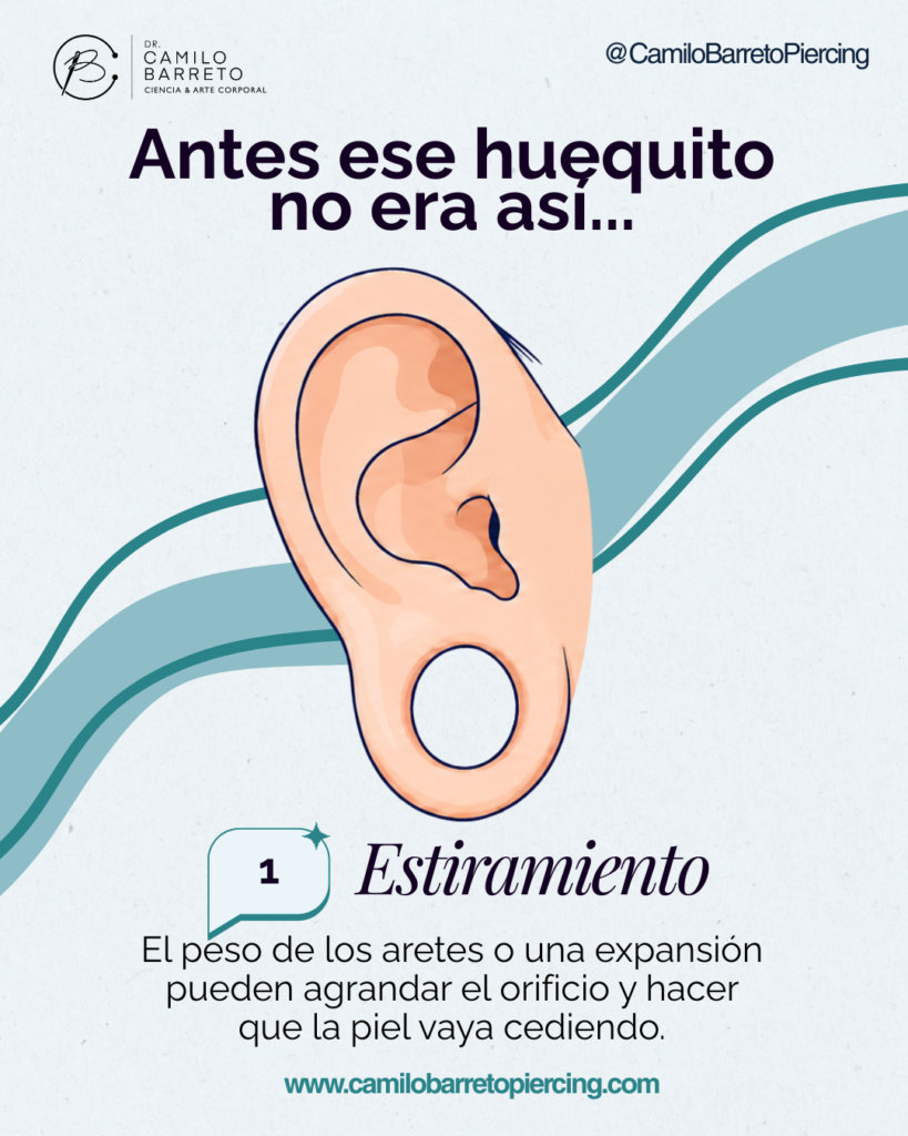 Lobuloplastia Camilo Barreto Piercing 3