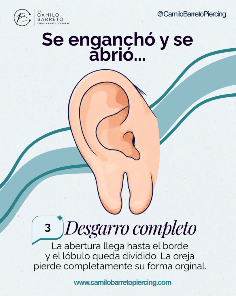 Lobuloplastia Camilo Barreto Piercing 2
